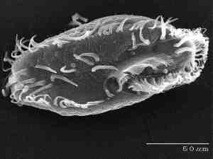 One species of ciliate as seen under the microscope
