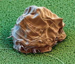 Scanning electron microscope image of a Tardigrade in its dehydrated “tun” form. Ph. credit - Eye of Science